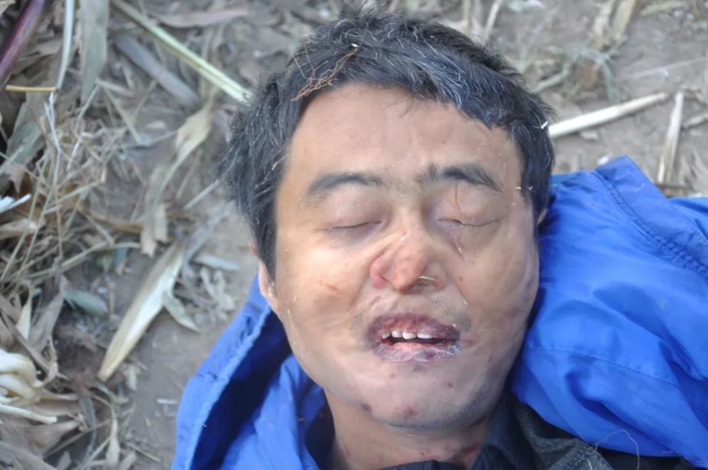 宁夏西吉发现一具无名男尸,警方悬赏1万寻找线索!