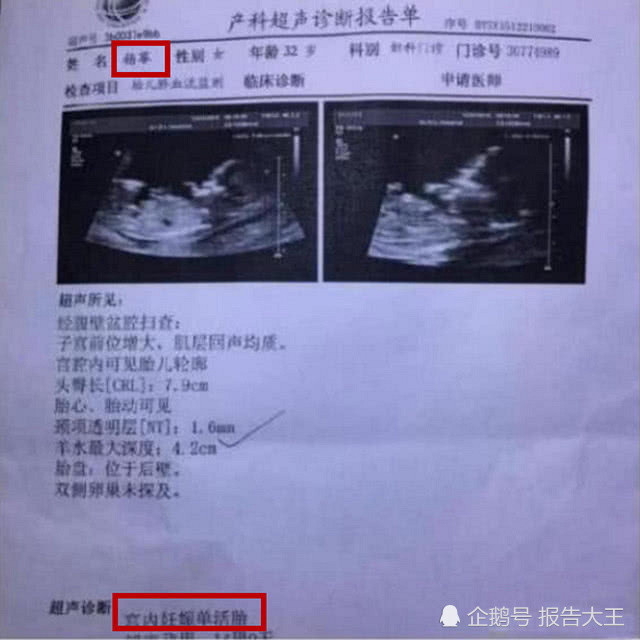 杨幂刘恺威离婚原因曝光已和李易峰领证结婚?