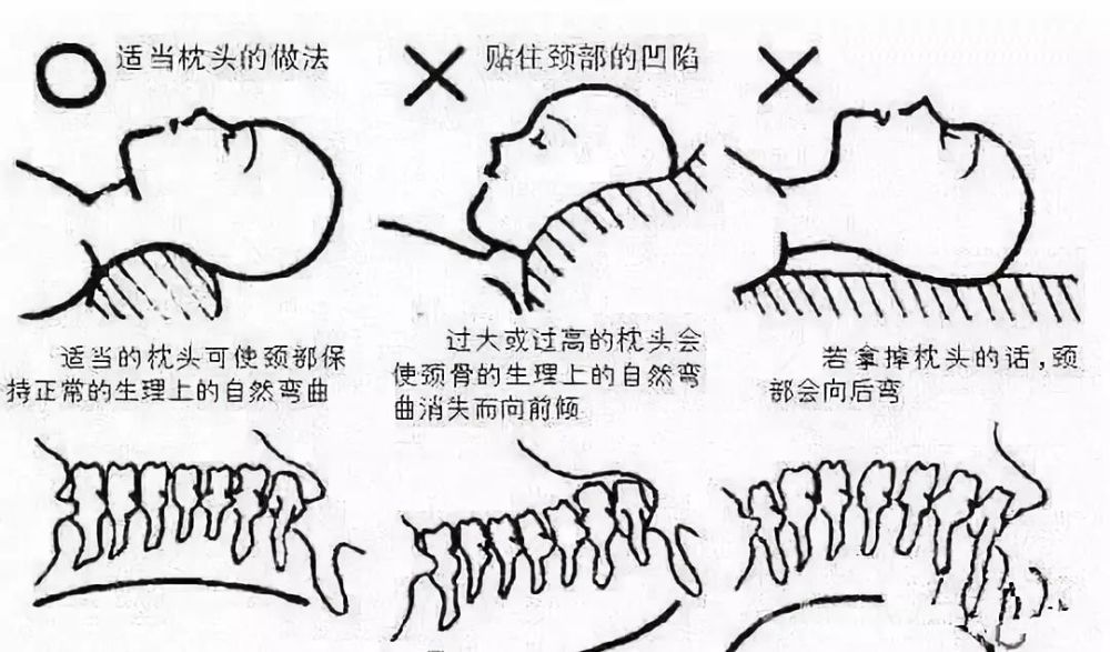 富貴包是奪命包8個方法教您消除富貴包