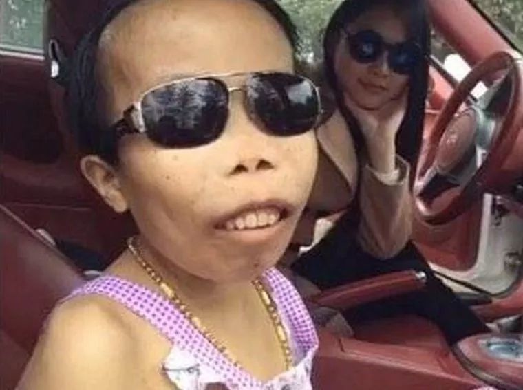 \