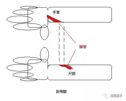 健康 中医所说的反关脉和斜飞脉是怎么回事?