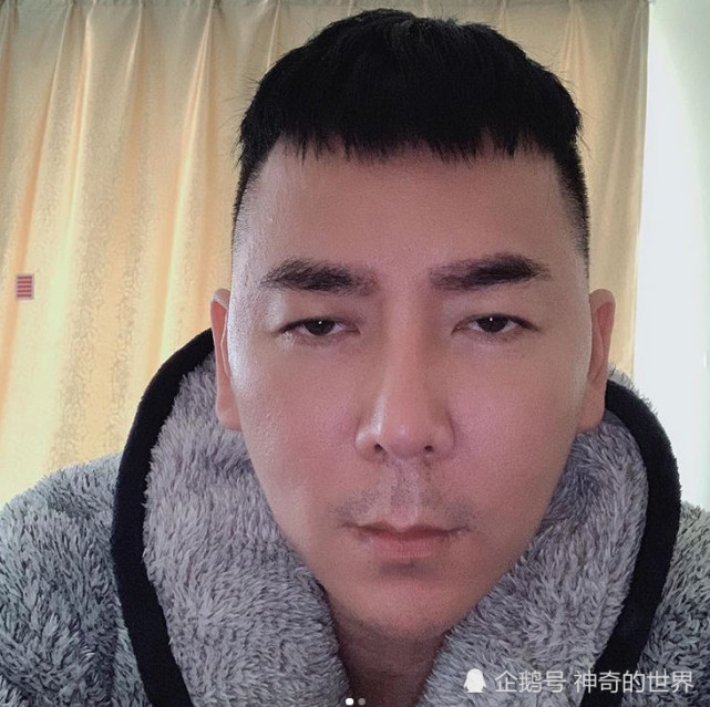 明星发型师去韩国整容失败成 猪头 称涉事医生败坏了韩国名声