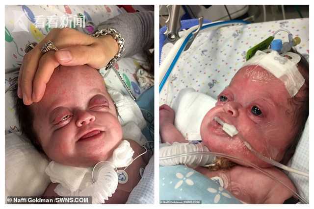 女子怀怪胎坚持将其生下网友你应该杀了她