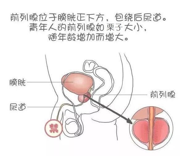 《都挺好》蘇大強頻繁起夜可能是前列腺增生徵兆!起幾次算正常?