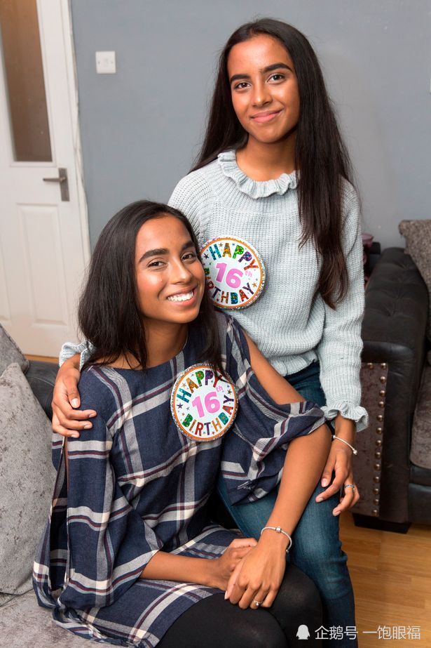 头部相连的连体双胞胎2岁半 小姐妹微笑面对即将到来的分离手术