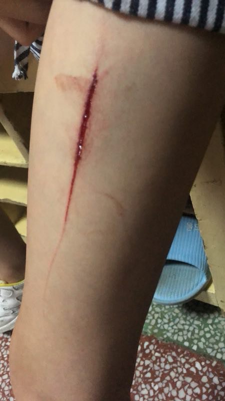 长沙一小孩在培训机构滑倒摔伤 家长理赔一波三折