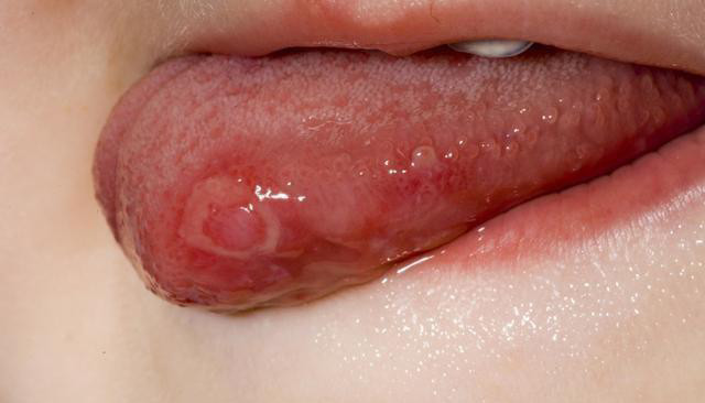 腾讯内容开放平台