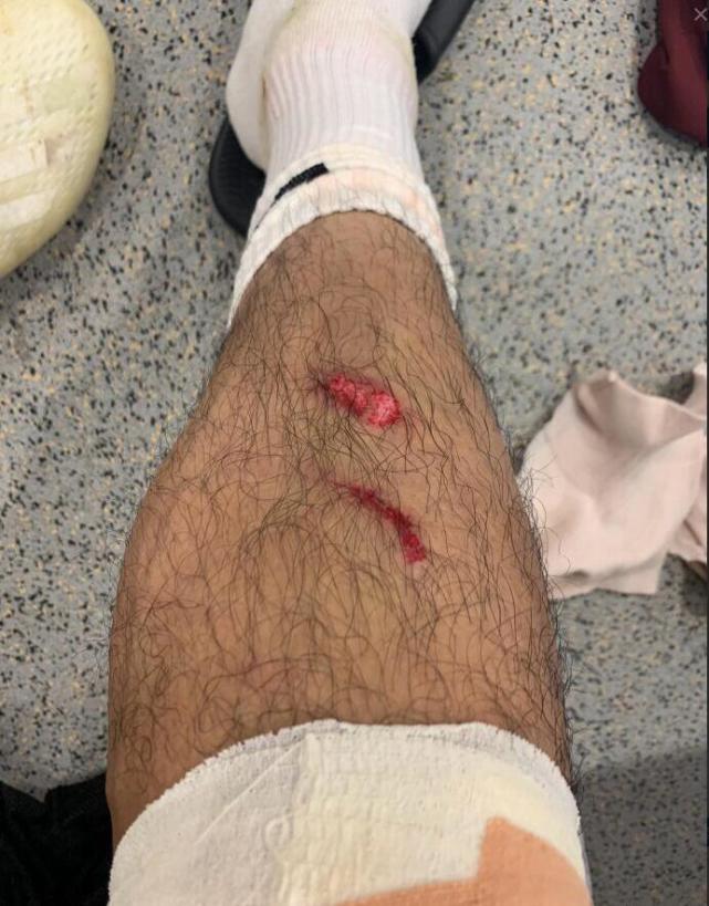 武磊打封闭!吴曦掉肉!国脚流血不流泪 掌声鼓励下呗