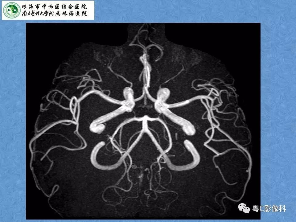 必读▕头颈部血管解剖及willis环常见变异,建议收藏_腾讯新闻