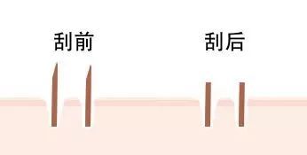 为什么就你体毛旺盛 难道是基因问题 腾讯新闻