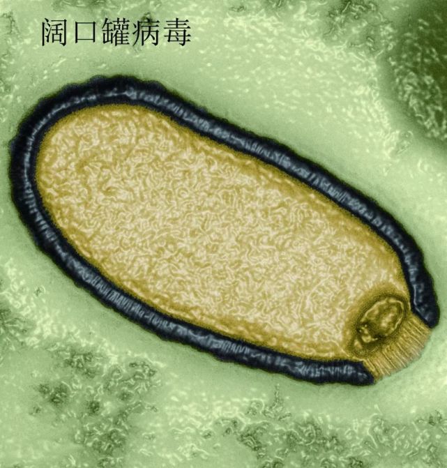 另一种威胁:在极地永久冻土中休眠了很长时间的古代病毒会苏醒过来