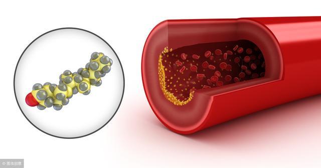 老大夫30年"降脂金方",溶血栓,降脂效果胜过10片他汀药!