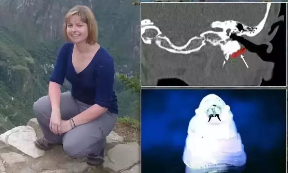 螺旋蛆螺旋蛆蝇