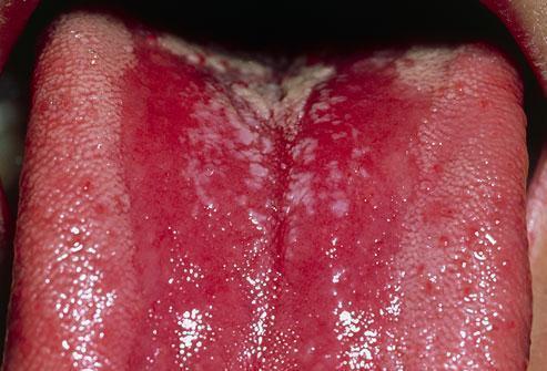 艾滋女为报复狂睡三百人,医生复查是误诊,其实