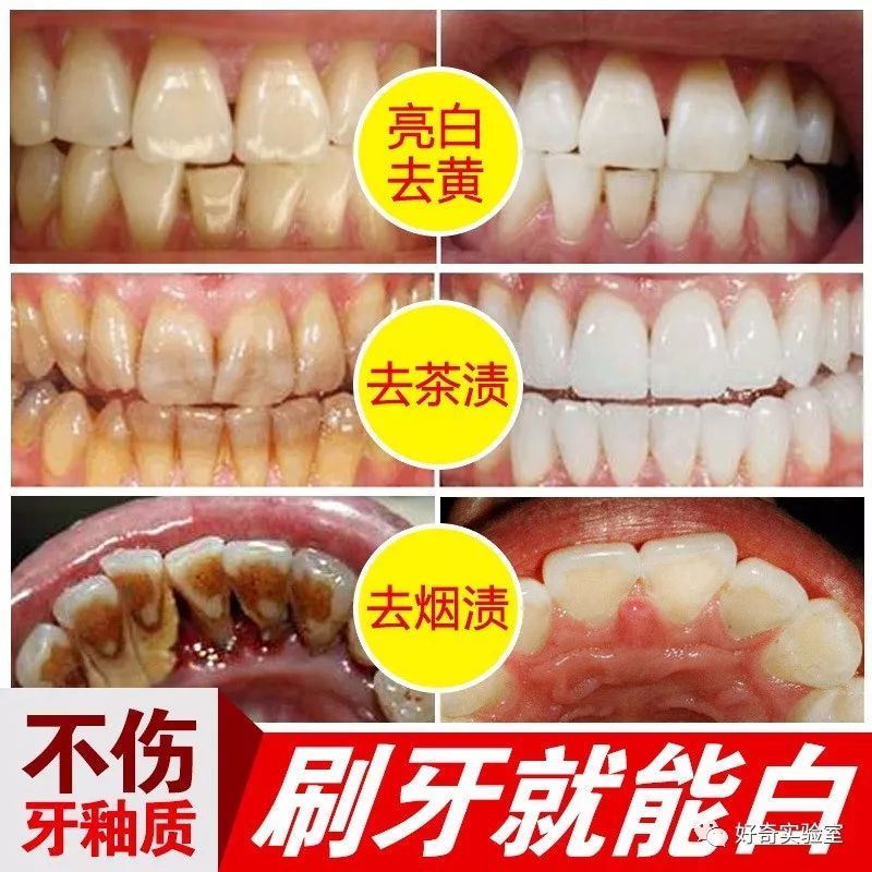 化妆品|牙膏将跻身化妆品界！几块钱和几十块钱的牙膏有什么区别？