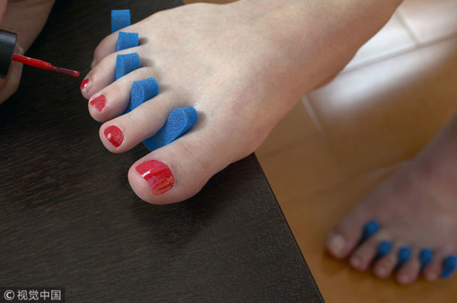 夏季老是反复 烂脚丫 你可能需要注意这几个事项 足部 真菌 烂脚丫 脚气