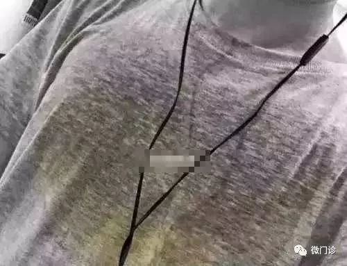 临终泻尸汗到底是什么解秘三种夺命汗