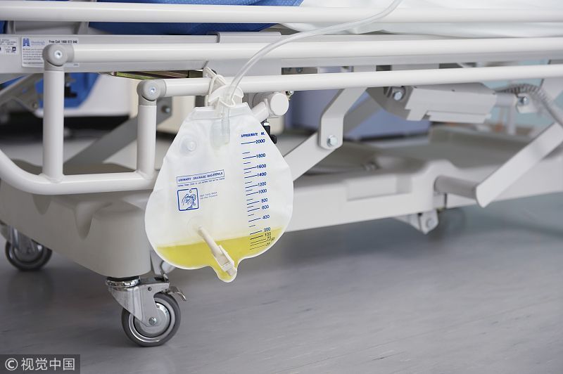 尿液|尿液出现异常，能反映身体情况？上完厕所后不妨多看一眼