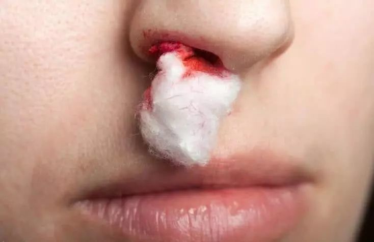 3,突然失语,吐字不清,听不懂别人的话,或出现嘴歪,流口水等.