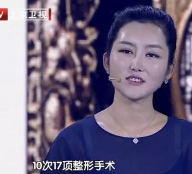 一名整容失败女演员的9年 10次手术后 我想彻底改变医美行业