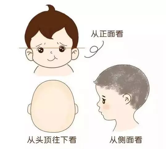 后脑勺|为什么别人有个圆润的后脑勺，我的却是扁的？
