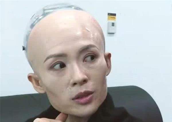 \