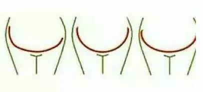 线条突出从左到右是倾斜状下来的有人做过统计发现,只需是女宝的肚子