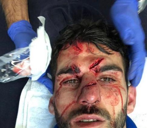 血腥莫点!踩踏伊布之人再惹事 对手被爆头