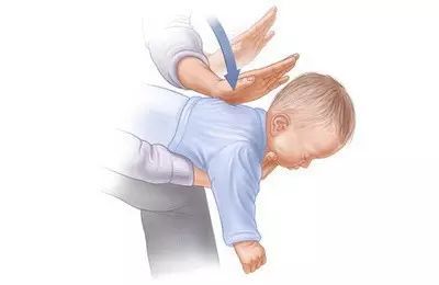 汤圆|5岁女童吃汤圆窒息！这个急救方法人人都得学……