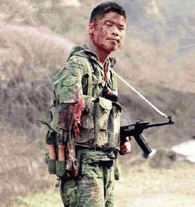 对越反击战19岁战士中弹奄奄一息对护士说抱抱我含泪而亡