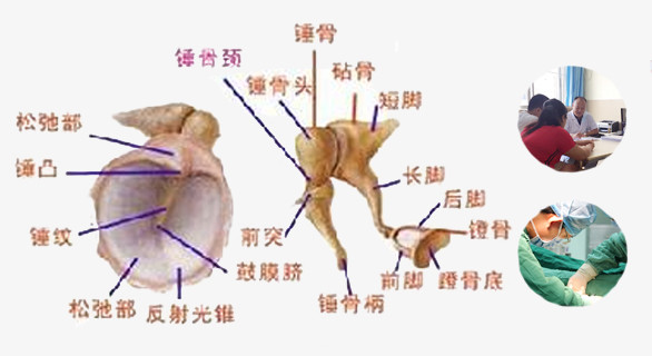 鼓膜内陷是什么回事 太原哪家医院可以治疗