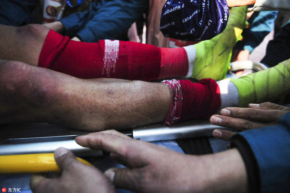 一文回顾大连球员恶意犯规秦升阴招断腿让人不寒而栗