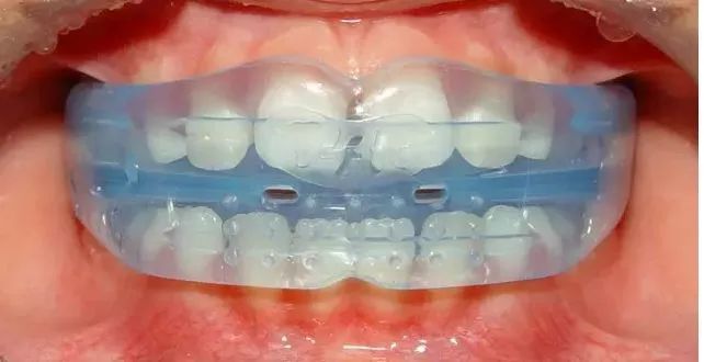 helen齿科中心你所不了解的肌功能训练器