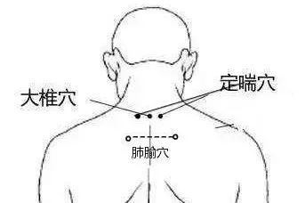 定喘的准确位置图片