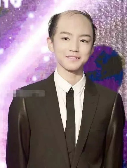 当男明星遇到葛优同款"地中海",鹿晗太违和,而他竟成神来之笔