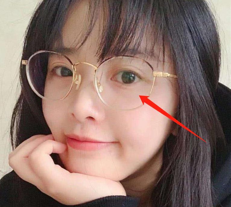 近视几度就得"戴眼镜"?否则度数会加深,医生:别超过这数