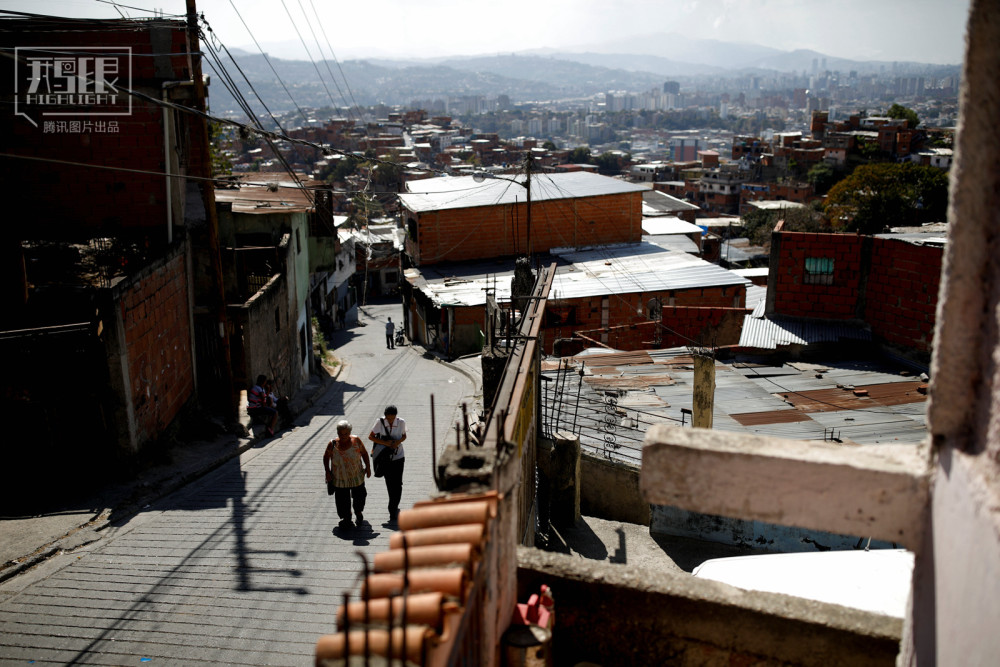 鹅眼:美女国度委内瑞拉,国民吃不饱严重营养不