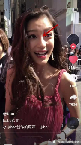 杨颖在阳光下出席活动,鼻子有假体透光?专家: