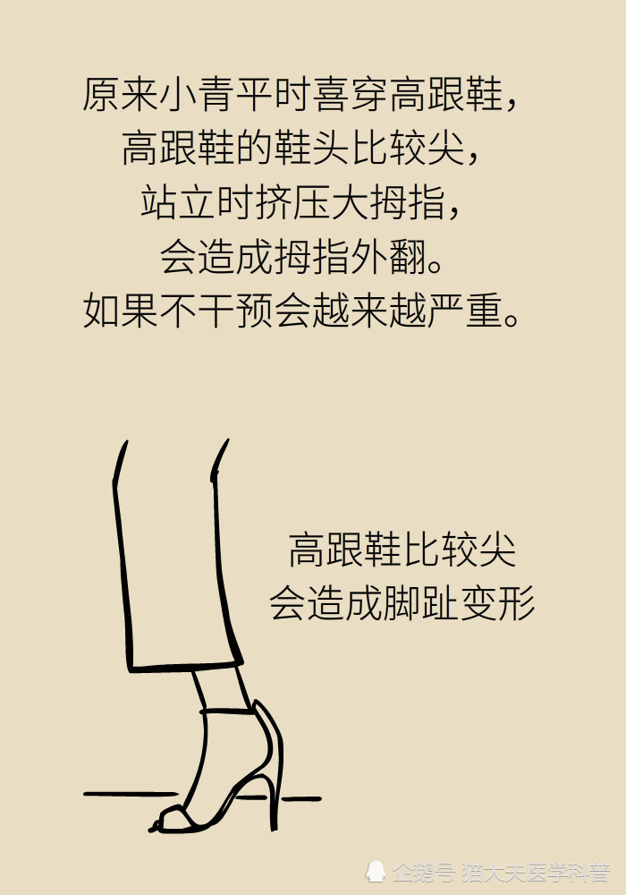 \