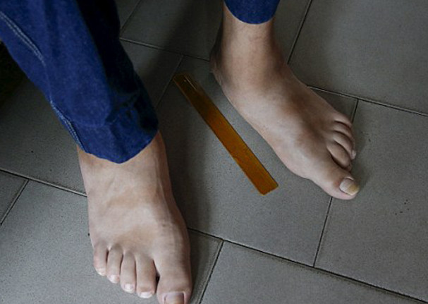 18岁男子拥有世界上最大的脚,苦恼找不到合适的鞋穿