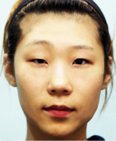 最丑眼型,死鱼眼只排第四!前三种简直没法看