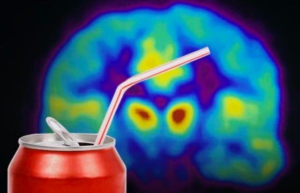 脑梗塞|14岁男孩突发脑梗，凶手竟然是它！这东西危害太大，一口从上到下毁全身