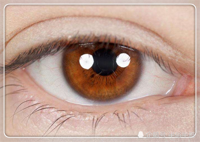 眼部有脂肪粒太难看 别急 只需抹这几样小东西 轻松告别脂肪粒 肌肤 按摩 酸奶 脂肪粒 眼部