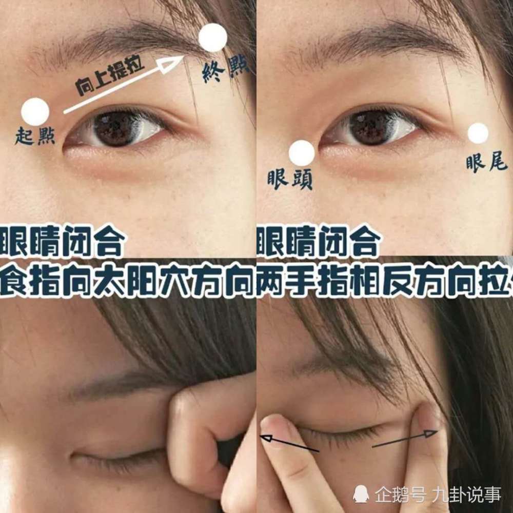 现在很多女生都是重度肿眼泡,本来双眼皮就不明显,再加上一个肿眼泡