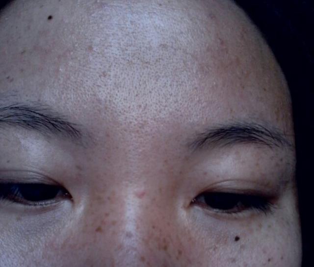 妇科中医:女人气血不足,面部暗沉长黄褐斑,3物调理逼退黑色素
