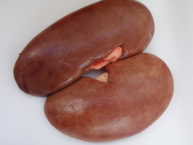 1.高盐食物慢性肾炎的水肿和血容量,钠盐的关系极大.