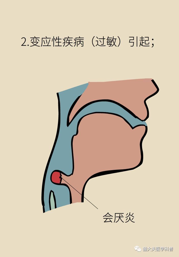 警惕这种咽喉急病会要命