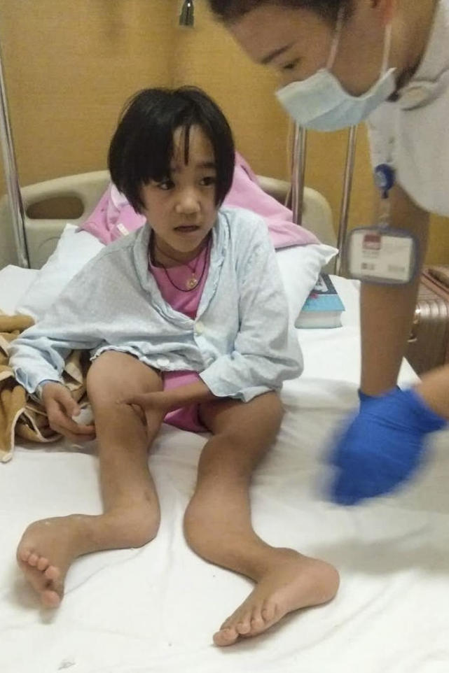 母亲王廷艳发现女儿哭声不止,后确诊为左肩关节骨折