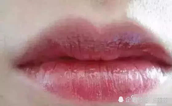 嘴唇颜色透露健康秘密 看看你的嘴唇是什么颜色 这3种要小心了 腾讯新闻