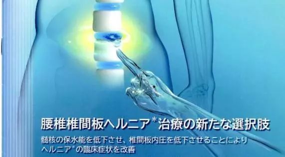椎间盘突出患者的福音HERNICORE一针见效